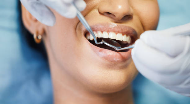 Best Knocked-Out Tooth Emergency  in Minnehaha, WA